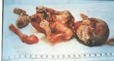abortion7.jpg