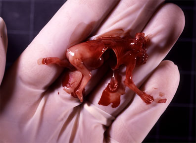 abortion8.bmp