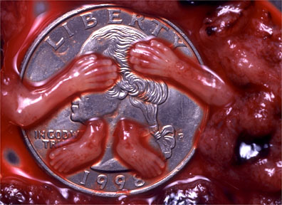 abortion9.bmp